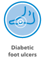 diabetic foot ulcers